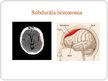 Prezentācija 'Centrālās nervu sistēmas traumatiski bojājumi', 16.
