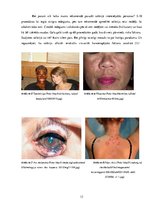Referāts 'Solārijs un ādas slimības', 13.