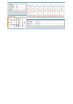 Konspekts 'Mājas darbs energoelektronikā', 6.