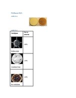 Referāts 'Ūdenspīpes kaitīgums', 23.