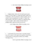 Referāts 'Zobu korekcijas nepieciešamība jauniešiem vecumā no 16 līdz 18 gadiem', 14.