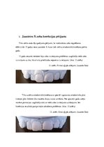 Referāts 'Zobu korekcijas nepieciešamība jauniešiem vecumā no 16 līdz 18 gadiem', 25.