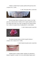 Referāts 'Zobu korekcijas nepieciešamība jauniešiem vecumā no 16 līdz 18 gadiem', 26.