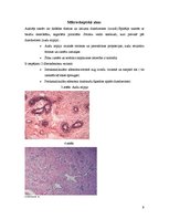 Konspekts 'Fibroadenoma. Fibrocistiska krūts slimība', 9.