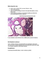 Konspekts 'Fibroadenoma. Fibrocistiska krūts slimība', 16.