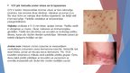 Prezentācija 'Herpes vīrusa mikrobioloģiskais raksturojums, vīrusa infekcijas izpausemes uz ād', 5.