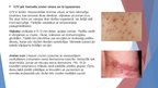 Prezentācija 'Herpes vīrusa mikrobioloģiskais raksturojums, vīrusa infekcijas izpausemes uz ād', 5.