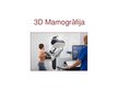 Prezentācija 'Kas ir mamogrāfija', 1.