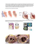 Prezentācija 'Mākslīgie sirds vārstuļi', 3.