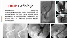Prezentācija 'Endoskopiska retrogrāda holangiopankreatogrāfija', 4.
