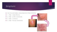 Prezentācija 'Herpess vīruss', 7.