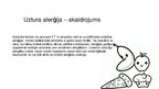 Prezentācija 'Uztura alerģijas', 2.