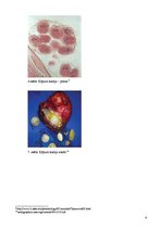 Prezentācija 'Ehinokokoze', 6.