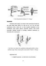 Diplomdarbs 'Ergonomisko risku novērtējums SIA "XXX" autoremonta iecirknī ', 10.