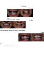 Referāts 'Zobu higiēna un tās ietekme uz zobu veselību', 36.