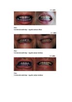 Referāts 'Zobu higiēna un tās ietekme uz zobu veselību', 37.