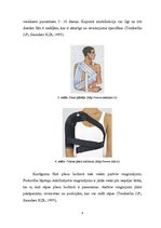 Referāts 'Hilla-Saksa lūzums pie pleca priekšējā izmežģījuma', 8.