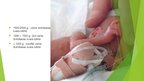 Prezentācija 'Priekšlaikus dzimis bērns', 3.
