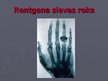 Prezentācija 'Rentgenstari', 8.