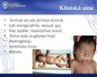 Prezentācija 'Iedzimtā hipotireoze', 8.