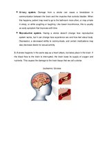 Konspekts 'Stroke', 2.