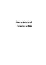 Referāts 'Stereotaktiskā neiroķirurģija', 1.