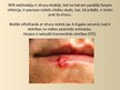 Prezentācija 'Herpes vīruss', 3.