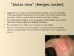 Prezentācija 'Herpes vīruss', 15.