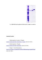 Referāts 'Gela elektroforēze un tās izmantošana proteīnu izdalīšanā', 5.