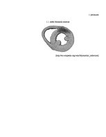 Referāts 'Miokarda infarkta ārstēšana un ājurvēdas profilakses metodes', 20.