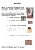 Konspekts 'Nagu slimības', 1.