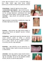 Konspekts 'Nagu slimības', 2.