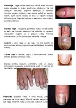 Konspekts 'Nagu slimības', 3.