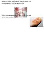 Konspekts 'Nagu slimības', 4.