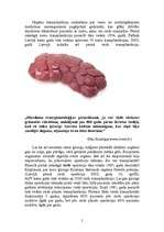 Referāts 'Nieru transplantācija', 2.