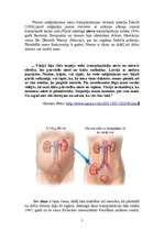 Referāts 'Nieru transplantācija', 3.