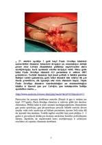 Referāts 'Nieru transplantācija', 5.