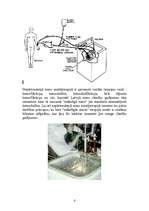Referāts 'Nieru transplantācija', 6.