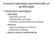 Prezentācija 'Invazīvās radioloģijas ārstēšanas metodes mūsdienu dzemdniecībā un ginekoloģijā', 3.