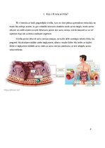 Referāts 'Krona slimība', 3.