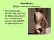 Prezentācija 'Sabiedrības zināšanas par bulīmiju un anoreksiju', 6.
