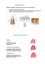 Konspekts 'Izņemamās zobu protēzes balstītas, uz implantiem', 4.