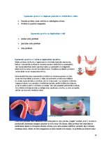 Konspekts 'Izņemamās zobu protēzes balstītas, uz implantiem', 14.