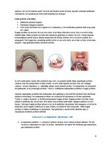 Konspekts 'Izņemamās zobu protēzes balstītas, uz implantiem', 15.