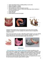 Konspekts 'Izņemamās zobu protēzes balstītas, uz implantiem', 18.