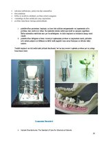 Konspekts 'Izņemamās zobu protēzes balstītas, uz implantiem', 29.