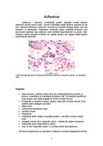 Referāts 'Azbests un veselība', 7.