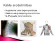 Prezentācija 'Mugurkaula kakla daļas spondiloze', 5.
