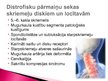 Prezentācija 'Mugurkaula kakla daļas spondiloze', 8.