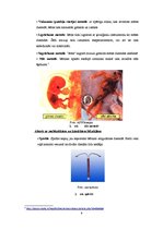 Referāts 'Aborts - slepkavība vai nē?', 6.